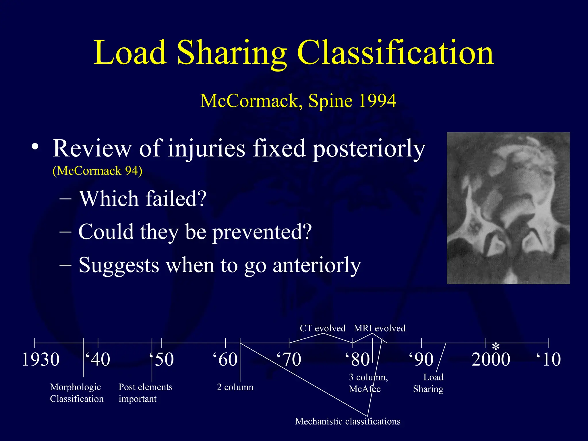 Load Sharing Classification
McCormack, Spine 1994
• Review of injuries fixed posteriorly
(McCormack 94)
– Which failed?
– Could they be prevented?
– Suggests when to go anteriorly
Morphologic
Classification
1930 ‘40 ‘50 ‘60 ‘70 ‘80 ‘90 2000 ‘10
CT evolved MRI evolved
*
Post elements
important
2 column
3 column,
McAfee
Mechanistic classifications
Load
Sharing
 