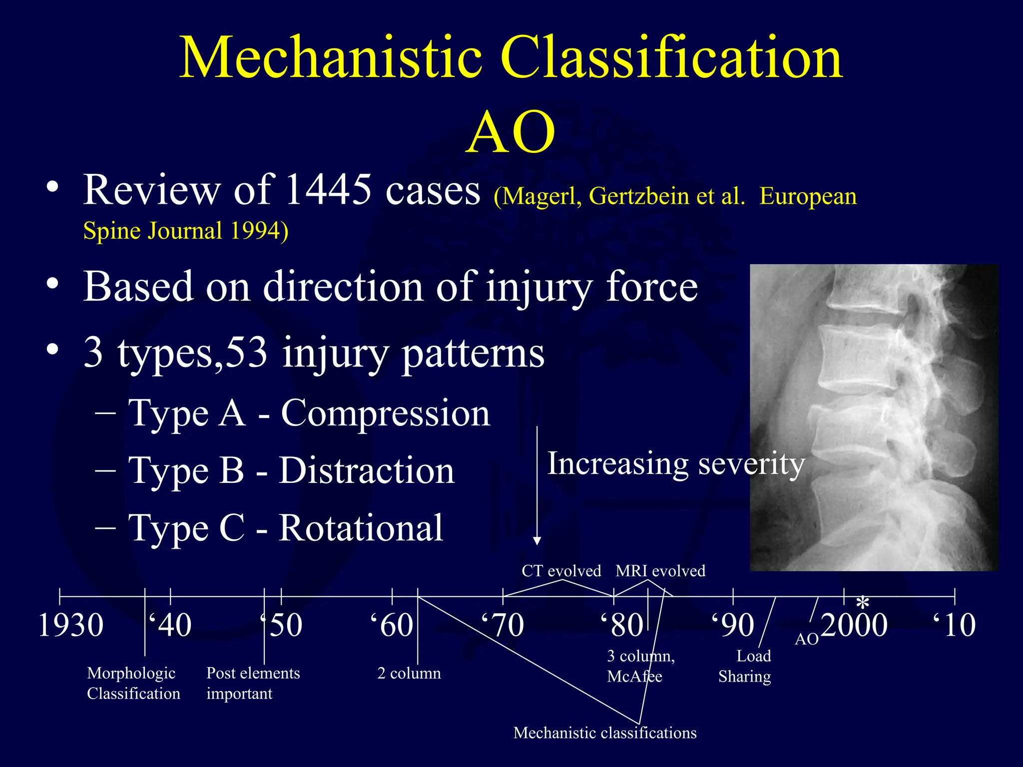 Mechanistic Classification
AO
• Review of 1445 cases (Magerl, Gertzbein et al. European
Spine Journal 1994)
• Based on direction of injury force
• 3 types,53 injury patterns
– Type A - Compression
– Type B - Distraction
– Type C - Rotational
Morphologic
Classification
1930 ‘40 ‘50 ‘60 ‘70 ‘80 ‘90 2000 ‘10
CT evolved MRI evolved
*
Post elements
important
2 column
3 column,
McAfee
Mechanistic classifications
Load
Sharing
AO
Increasing severity
 