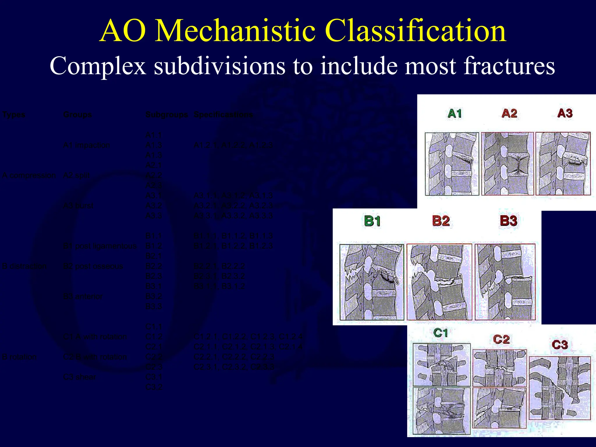 AO Mechanistic Classification
Complex subdivisions to include most fractures
Types Groups Subgroups Specificastions
A1.1
A1 impaction A1.3 A1.2.1, A1.2.2, A1.2.3
A1.3
A2.1
A compression A2 split A2.2
A2.3
A3.1 A3.1.1, A3.1.2, A3.1.3
A3 burst A3.2 A3.2.1, A3.2.2, A3.2.3
A3.3 A3.3.1, A3.3.2, A3.3.3
B1.1 B1.1.1, B1.1.2, B1.1.3
B1 post ligamentous B1.2 B1.2.1, B1.2.2, B1.2.3
B2.1
B distraction B2 post osseous B2.2 B2.2.1, B2.2.2
B2.3 B2.3.1, B2.3.2
B3.1 B3.1.1, B3.1.2
B3 anterior B3.2
B3.3
C1.1
C1 A with rotation C1.2 C1.2.1, C1.2.2, C1.2.3, C1.2.4
C2.1 C2.1.1, C2.1.2, C2.1.3, C2.1.4
B rotation C2 B with rotation C2.2 C2.2.1, C2.2.2, C2.2.3
C2.3 C2.3.1, C2.3.2, C2.3.3
C3 shear C3.1
C3.2
 