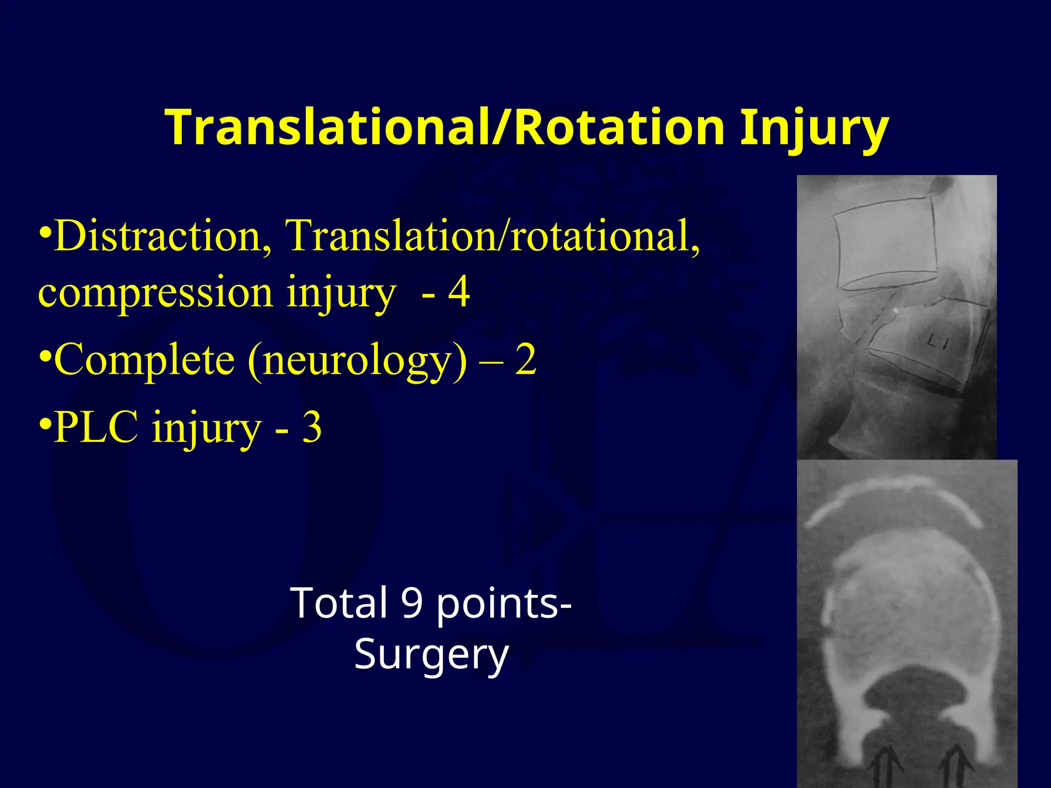 Translational/Rotation Injury
•Distraction, Translation/rotational,
compression injury - 4
•Complete (neurology) – 2
•PLC injury - 3
Total 9 points-
Surgery
 
