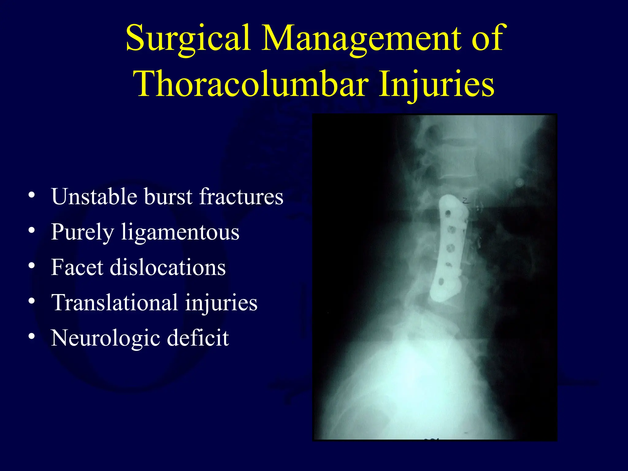 Surgical Management of
Thoracolumbar Injuries
• Unstable burst fractures
• Purely ligamentous
• Facet dislocations
• Translational injuries
• Neurologic deficit
 
