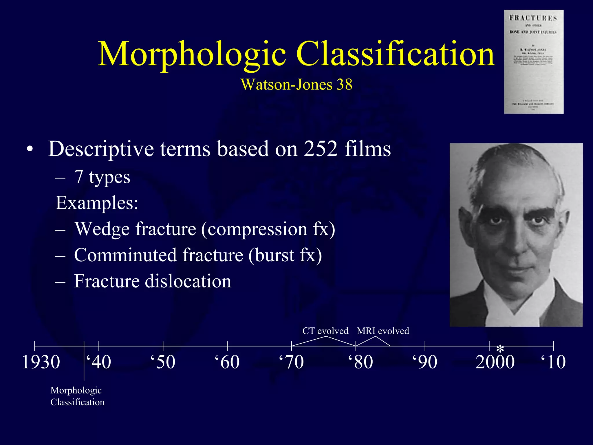Morphologic Classification
Watson-Jones 38
• Descriptive terms based on 252 films
– 7 types
Examples:
– Wedge fracture (compression fx)
– Comminuted fracture (burst fx)
– Fracture dislocation
Morphologic
Classification
1930 ‘40 ‘50 ‘60 ‘70 ‘80 ‘90 2000 ‘10
CT evolved MRI evolved
*
 