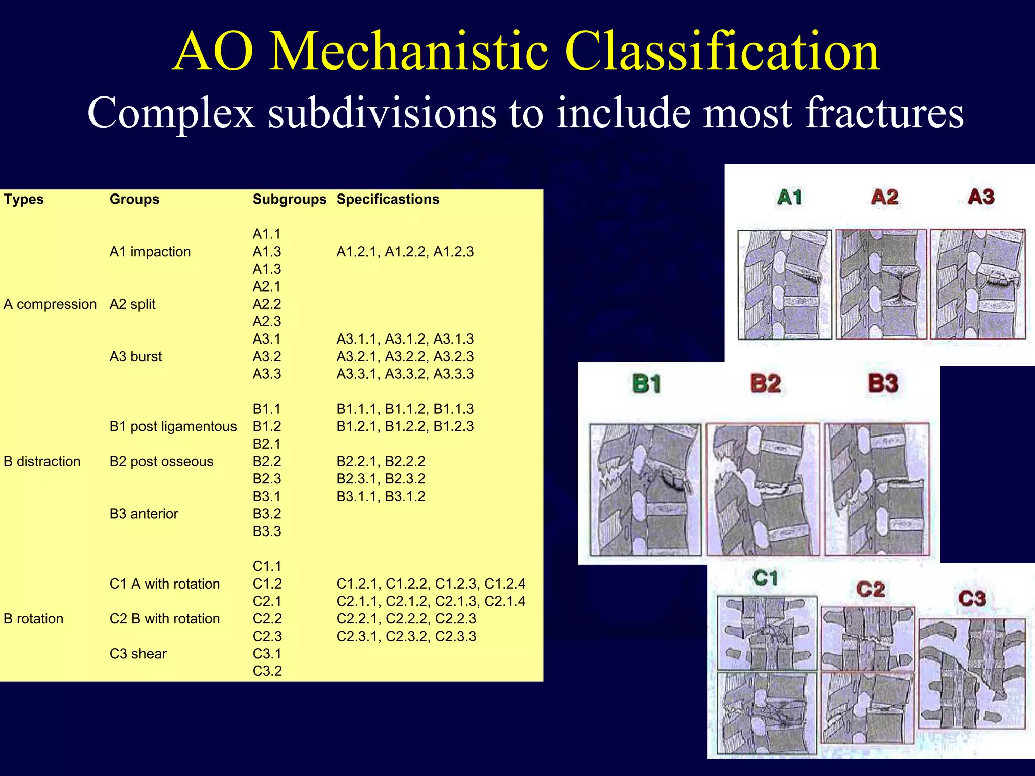 AO Mechanistic Classification
Complex subdivisions to include most fractures
Types Groups Subgroups Specificastions
A1.1
A1 impaction A1.3 A1.2.1, A1.2.2, A1.2.3
A1.3
A2.1
A compression A2 split A2.2
A2.3
A3.1 A3.1.1, A3.1.2, A3.1.3
A3 burst A3.2 A3.2.1, A3.2.2, A3.2.3
A3.3 A3.3.1, A3.3.2, A3.3.3
B1.1 B1.1.1, B1.1.2, B1.1.3
B1 post ligamentous B1.2 B1.2.1, B1.2.2, B1.2.3
B2.1
B distraction B2 post osseous B2.2 B2.2.1, B2.2.2
B2.3 B2.3.1, B2.3.2
B3.1 B3.1.1, B3.1.2
B3 anterior B3.2
B3.3
C1.1
C1 A with rotation C1.2 C1.2.1, C1.2.2, C1.2.3, C1.2.4
C2.1 C2.1.1, C2.1.2, C2.1.3, C2.1.4
B rotation C2 B with rotation C2.2 C2.2.1, C2.2.2, C2.2.3
C2.3 C2.3.1, C2.3.2, C2.3.3
C3 shear C3.1
C3.2
 