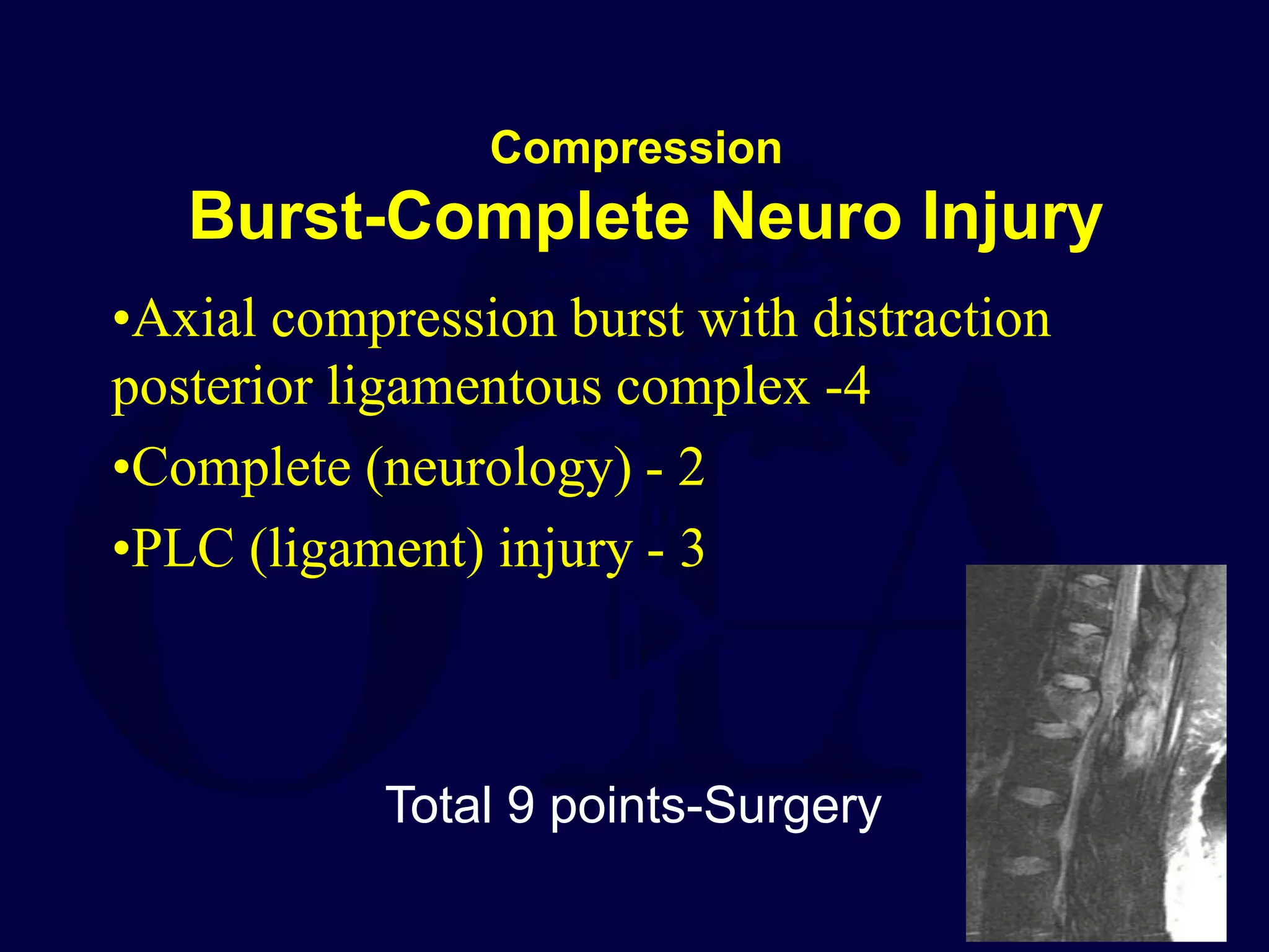 Compression
Burst-Complete Neuro Injury
•Axial compression burst with distraction
posterior ligamentous complex -4
•Complete (neurology) - 2
•PLC (ligament) injury - 3
Total 9 points-Surgery
 