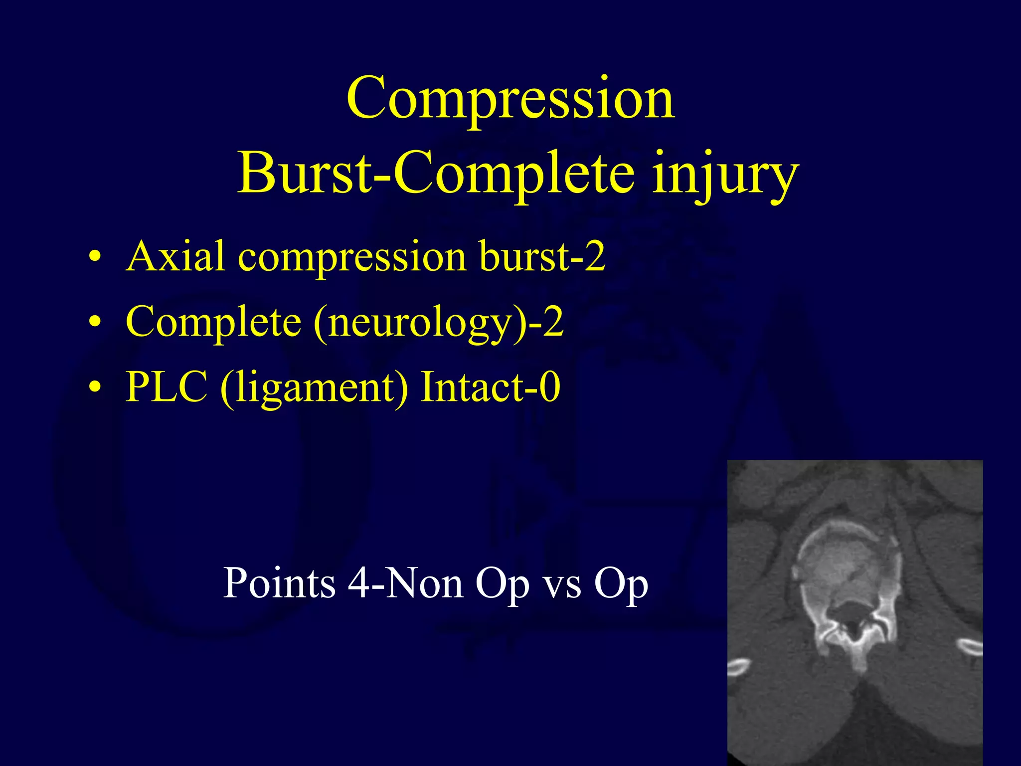 Compression
Burst-Complete injury
• Axial compression burst-2
• Complete (neurology)-2
• PLC (ligament) Intact-0
Points 4-Non Op vs Op
 