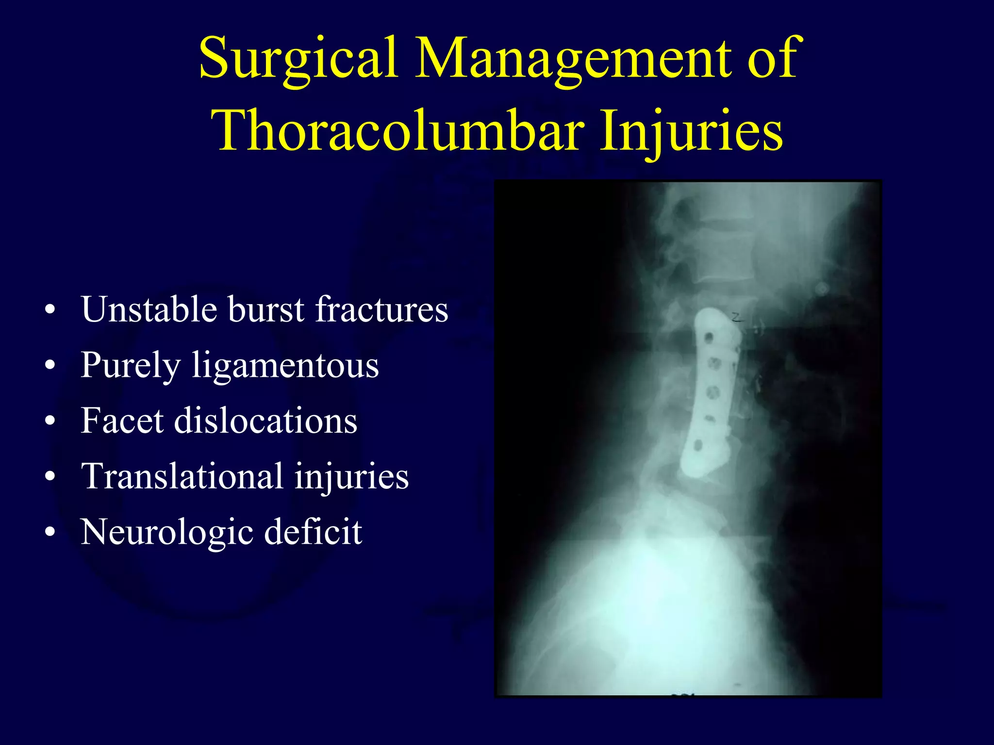 Surgical Management of
Thoracolumbar Injuries
• Unstable burst fractures
• Purely ligamentous
• Facet dislocations
• Translational injuries
• Neurologic deficit
 