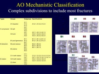 S4_Classification-Thoracolumar-Spine.ppt