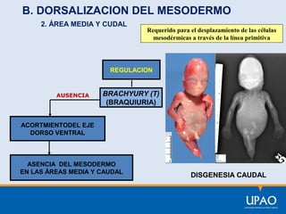 B. DORSALIZACION DEL MESODERMO
2. ÁREA MEDIA Y CUDAL

Requerido para el desplazamiento de las células
mesodérmicas a través de la línea primitiva

REGULACION

AUSENCIA

BRACHYURY (T)
(BRAQUIURIA)

ACORTMIENTODEL EJE
DORSO VENTRAL

ASENCIA DEL MESODERMO
EN LAS ÁREAS MEDIA Y CAUDAL

DISGENESIA CAUDAL

 