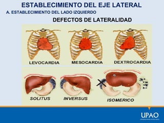 ESTABLECIMIENTO DEL EJE LATERAL
A. ESTABLECIMIENTO DEL LADO IZQUIERDO

DEFECTOS DE LATERALIDAD

 