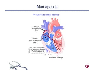Marcapasos Fibras de Purkinje Haz de His Propagación de señales eléctricas 