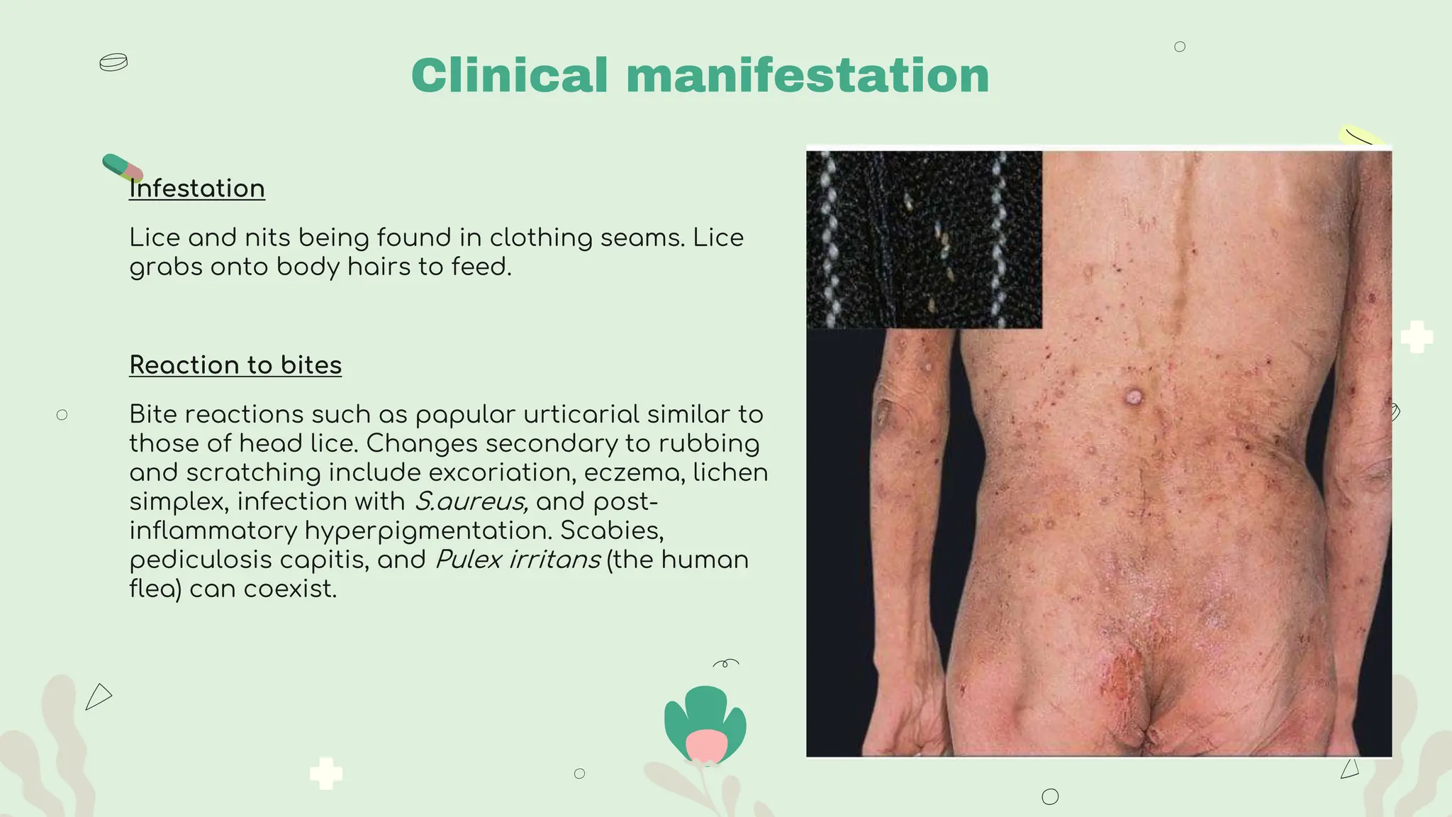 Scabies & Parasitic Infestations (Impetigo) | PPTX