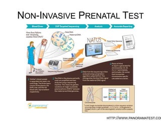 NON-INVASIVE PRENATAL TEST
HTTP://WWW.PANORAMATEST.COM/
 