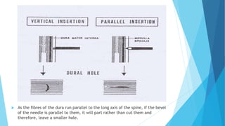  As the fibres of the dura run parallel to the long axis of the spine, if the bevel
of the needle is parallel to them, it will part rather than cut them and
therefore, leave a smaller hole.
 