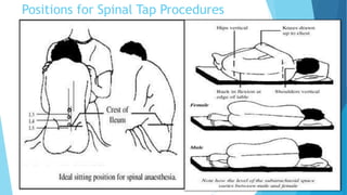 Positions for Spinal Tap Procedures
 