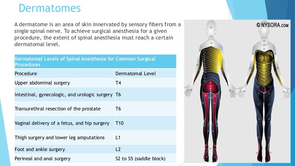 Spinal Anesthesia A Comprehensive Approach