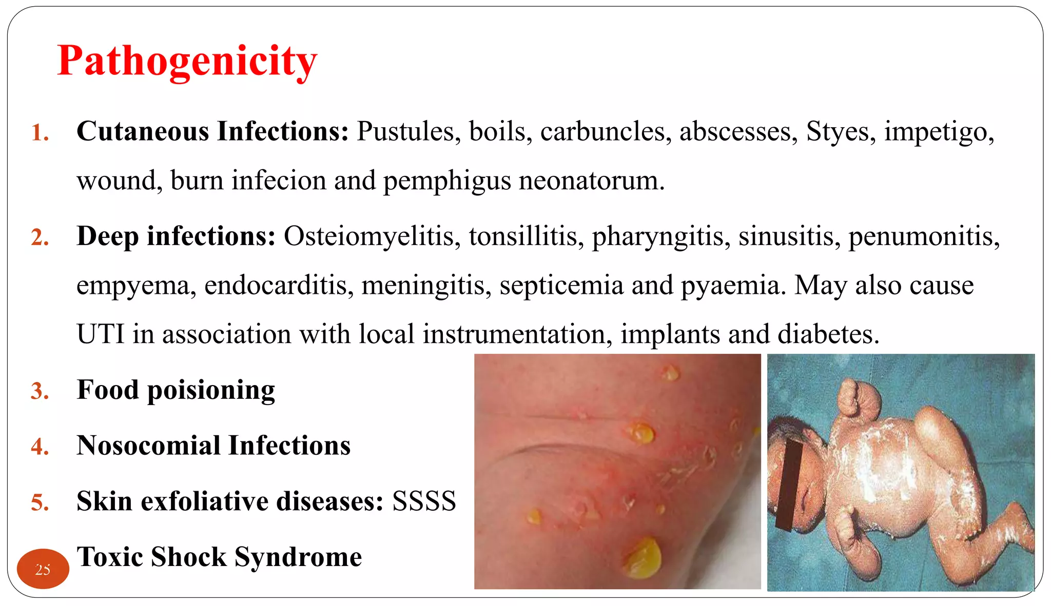 Pathogenicity
25
1. Cutaneous Infections: Pustules, boils, carbuncles, abscesses, Styes, impetigo,
wound, burn infecion and pemphigus neonatorum.
2. Deep infections: Osteiomyelitis, tonsillitis, pharyngitis, sinusitis, penumonitis,
empyema, endocarditis, meningitis, septicemia and pyaemia. May also cause
UTI in association with local instrumentation, implants and diabetes.
3. Food poisioning
4. Nosocomial Infections
5. Skin exfoliative diseases: SSSS
6. Toxic Shock Syndrome
 