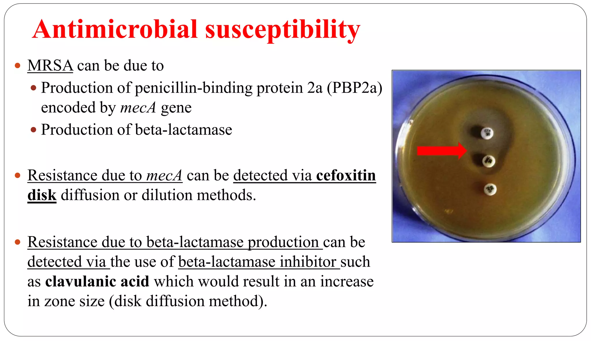 Antimicrobial susceptibility
29
 MRSA can be due to
 Production of penicillin-binding protein 2a (PBP2a)
encoded by mecA gene
 Production of beta-lactamase
 Resistance due to mecA can be detected via cefoxitin
disk diffusion or dilution methods.
 Resistance due to beta-lactamase production can be
detected via the use of beta-lactamase inhibitor such
as clavulanic acid which would result in an increase
in zone size (disk diffusion method).
 