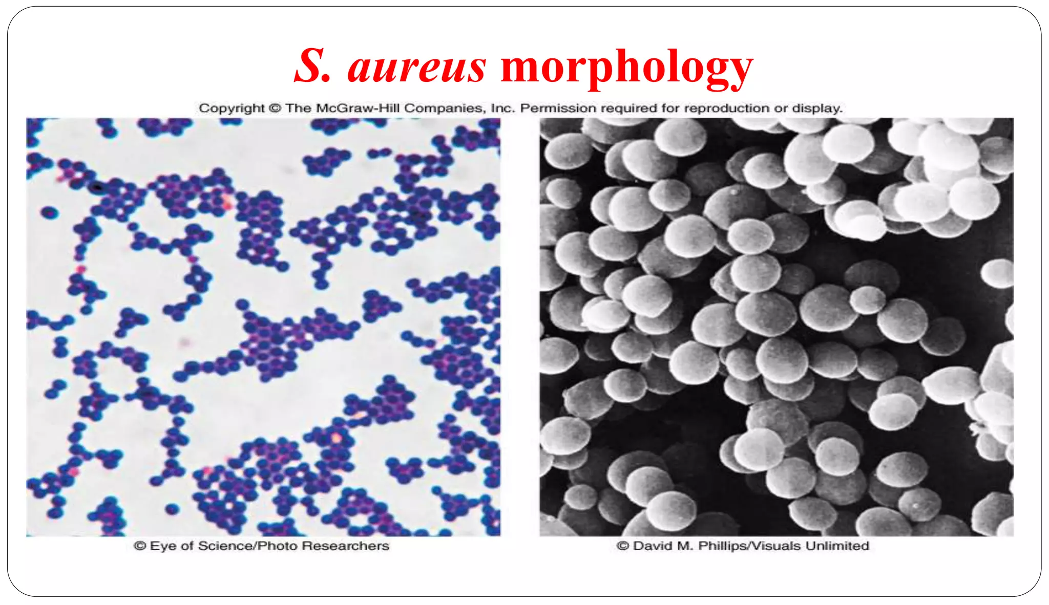 S. aureus morphology
3
 