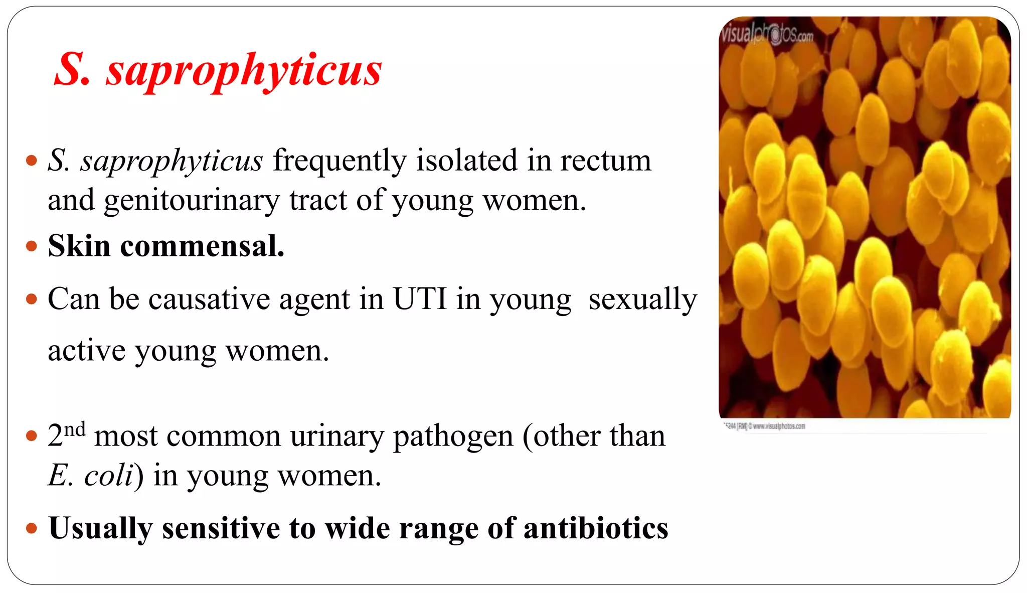 S. saprophyticus
42
 S. saprophyticus frequently isolated in rectum
and genitourinary tract of young women.
 Skin commensal.
 Can be causative agent in UTI in young sexually
active young women.
 2nd most common urinary pathogen (other than
E. coli) in young women.
 Usually sensitive to wide range of antibiotics
 
