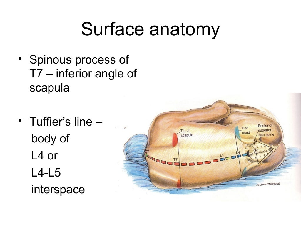 SPINAL ANAESTHESIA