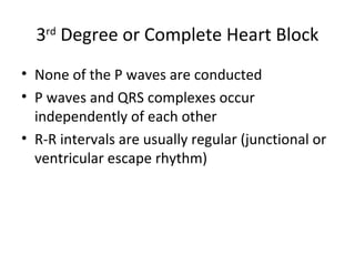 ECG Lecture: Sinus arrest, sinoatrial exit block, AV block and escape ...