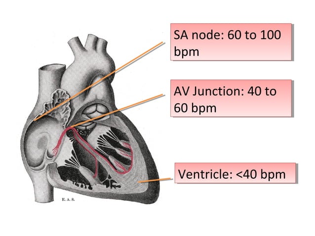 ECG Lecture: Sinus arrest, sinoatrial exit block, AV block and escape ...