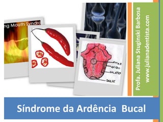 Síndrome da Ardência  Bucal Profa. Juliana Stuginski Barbosa www.julianadentista.com 