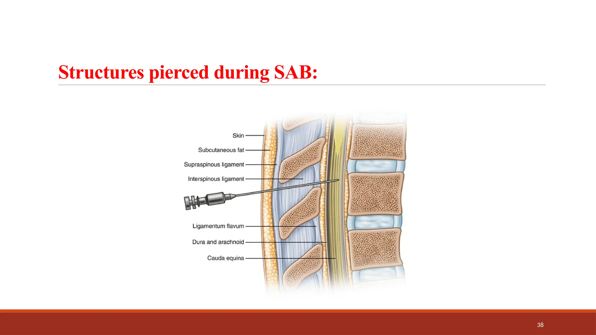 38
Structures pierced during SAB:
 