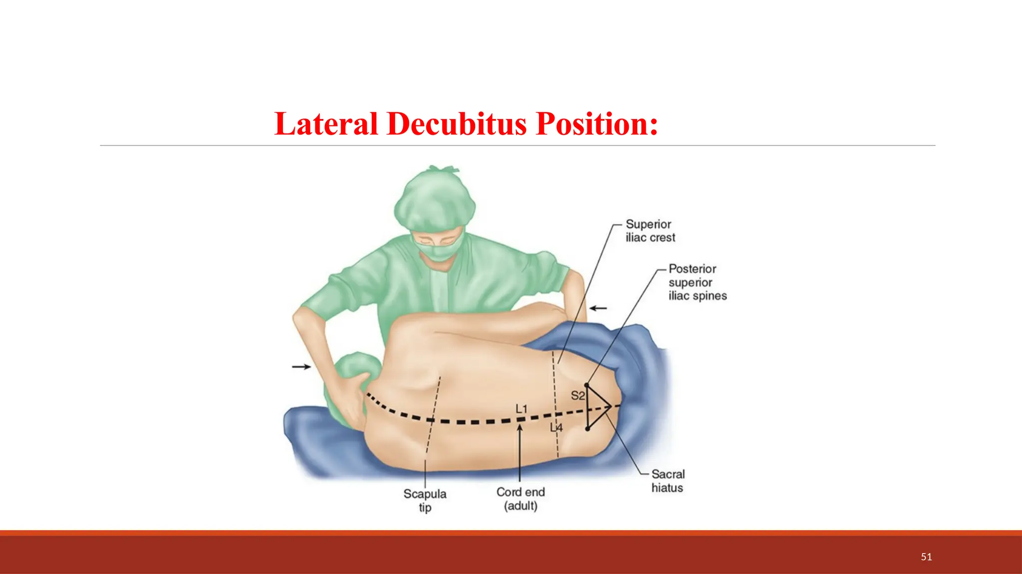 51
Lateral Decubitus Position:
 