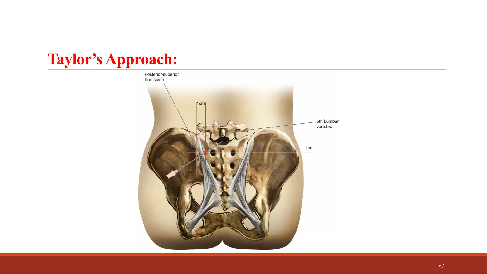 67
Taylor’s Approach:
 