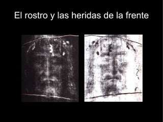 El rostro y las heridas de la frente 