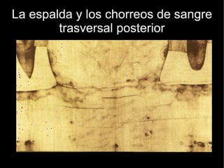 La espalda y los chorreos de sangre trasversal posterior 