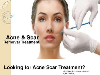 Looking for Acne Scar Treatment?
http://sabclinic.com/acne-scar-
reduction.html
Acne & Scar
Removal Treatment
 