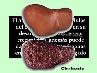 El alcohol destruye las células
del cerebro e interfiere en su
desarrollo natural y en su
crecimiento. además puede
dañar también otros órganos
en desarrollo como el hígado

 