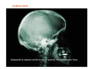 Golpearte la cabeza contra la pared quema 150 calorías por hora.  