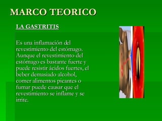MARCO TEORICO LA GASTRITIS Es una inflamación del revestimiento del estómago. Aunque el revestimiento del estómago es bastante fuerte y puede resistir ácidos fuertes, el beber demasiado alcohol, comer alimentos picantes o fumar puede causar que el revestimiento se inflame y se irrite. 