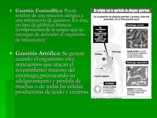 Gastritis Eosinofílica : Puede resultar de una reacción alérgica a una infestación de gusanos. En ésta, un tipo de glóbulos blancos (componentes de la sangre que se encargan de defender al organismo de infecciones)   Gastritis Atrófica:  Se genera cuando el organismo crea anticuerpos que atacan el revestimiento mucoso del estómago, provocando su adelgazamiento y pérdida de muchas o de todas las células productoras de ácido y enzimas 