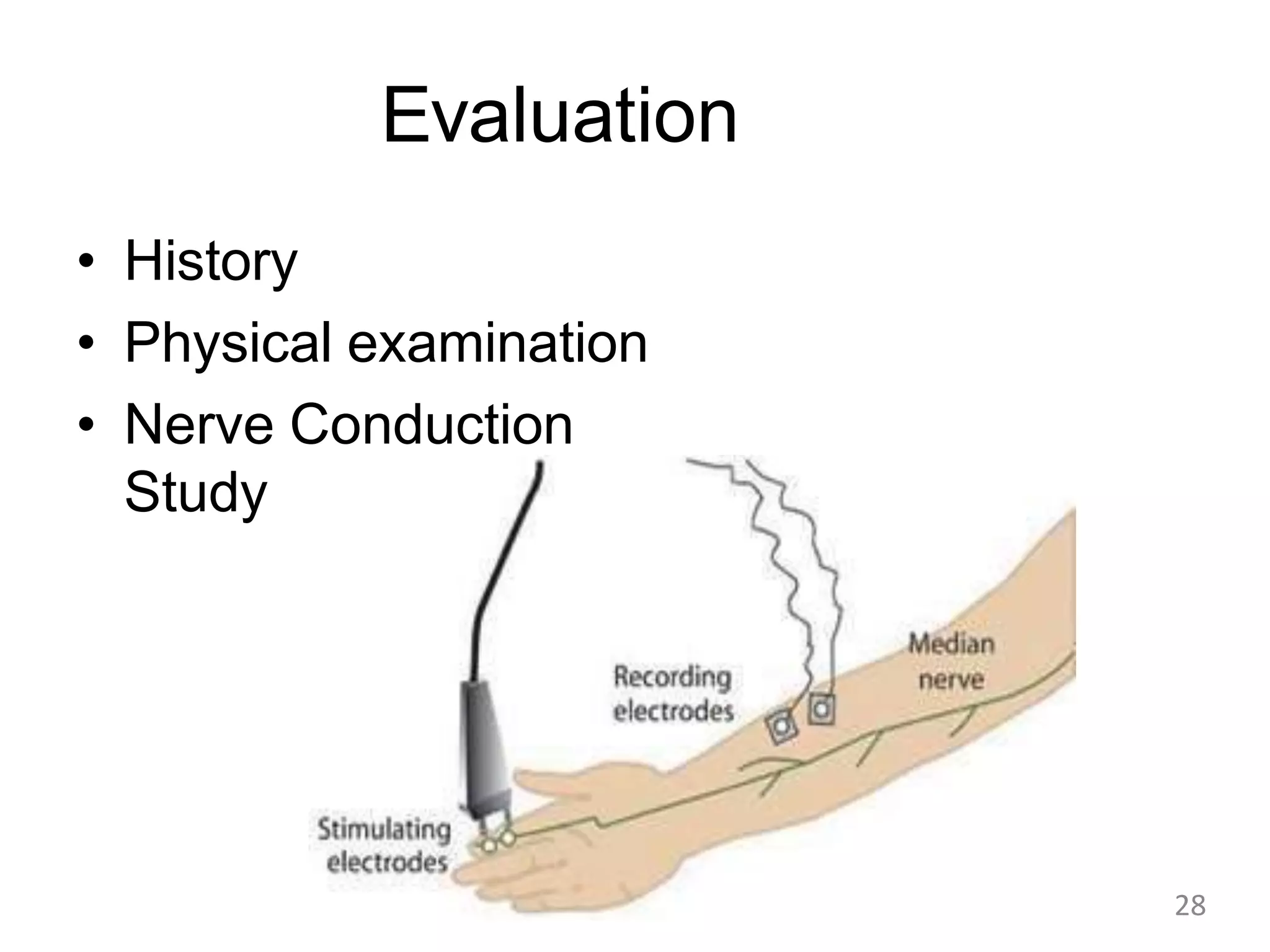 Evaluation
• History
• Physical examination
• Nerve Conduction
Study
28
 