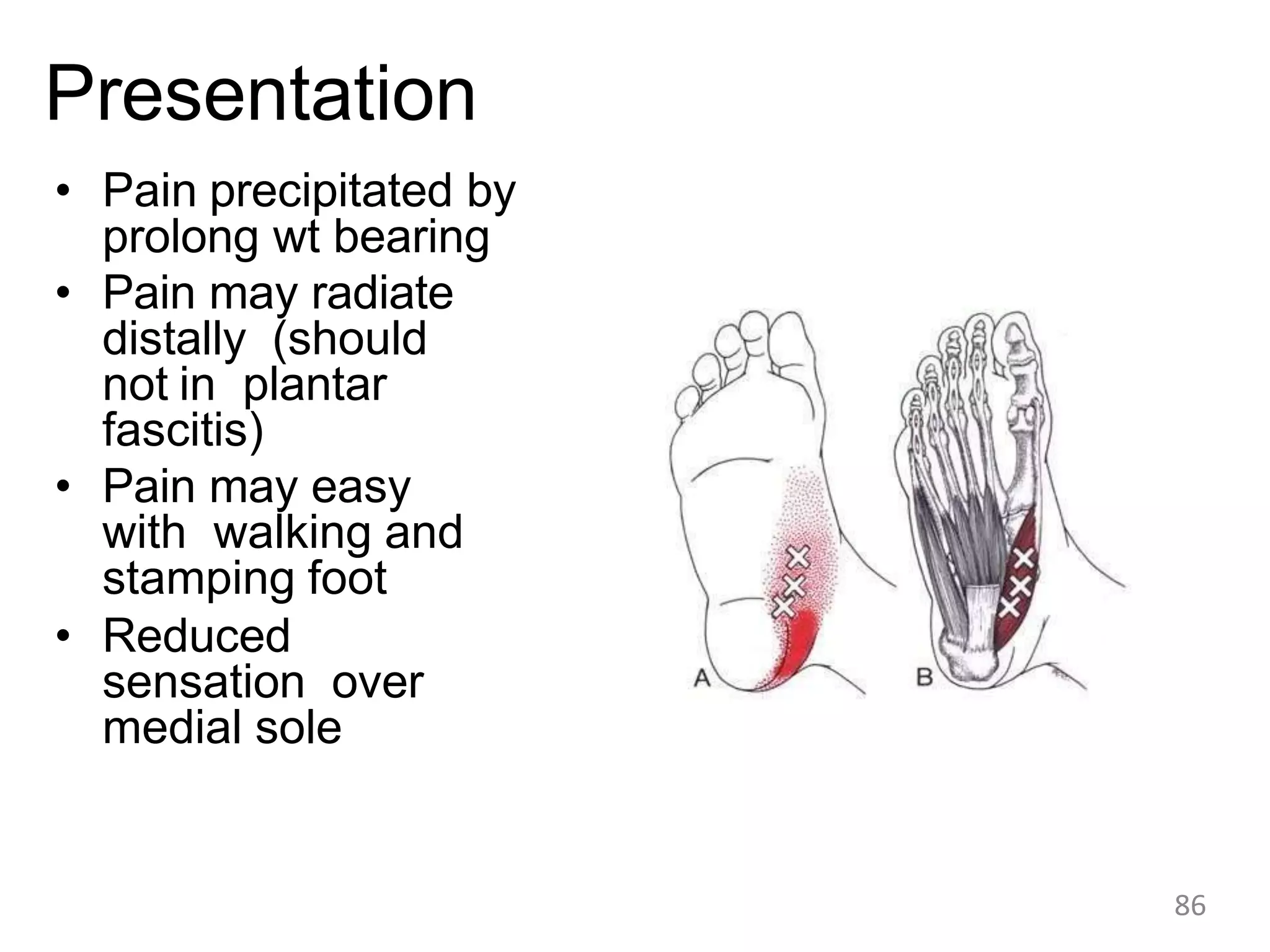 Presentation
• Pain precipitated by
prolong wt bearing
• Pain may radiate
distally (should
not in plantar
fascitis)
• Pain may easy
with walking and
stamping foot
• Reduced
sensation over
medial sole
86
 