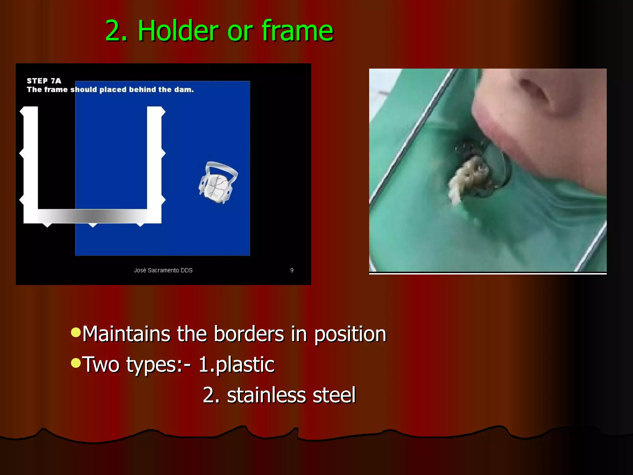 2. Holder or frame Maintains the borders in position Two types:- 1.plastic 2. stainless steel 