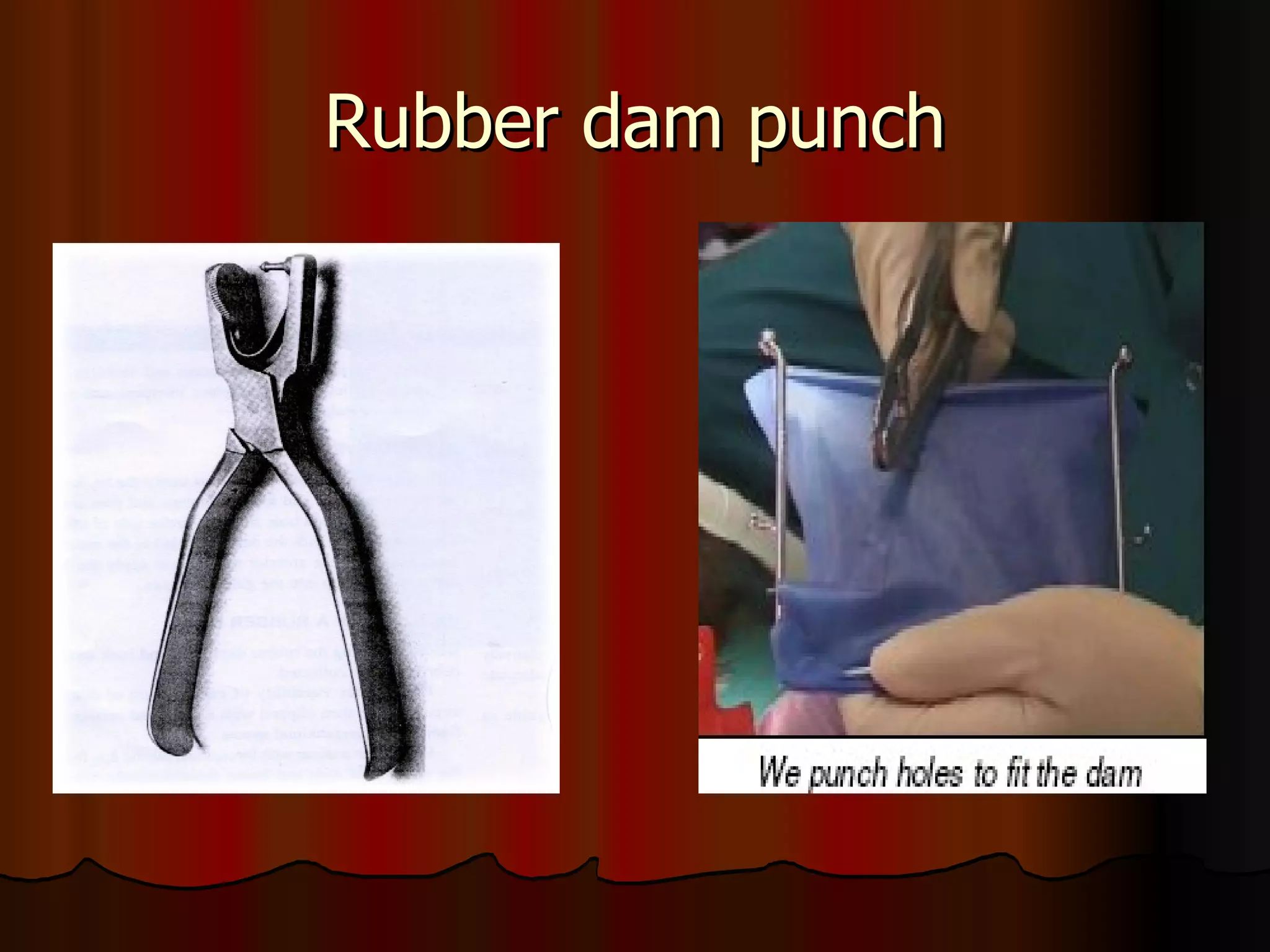 Rubber dam punch 