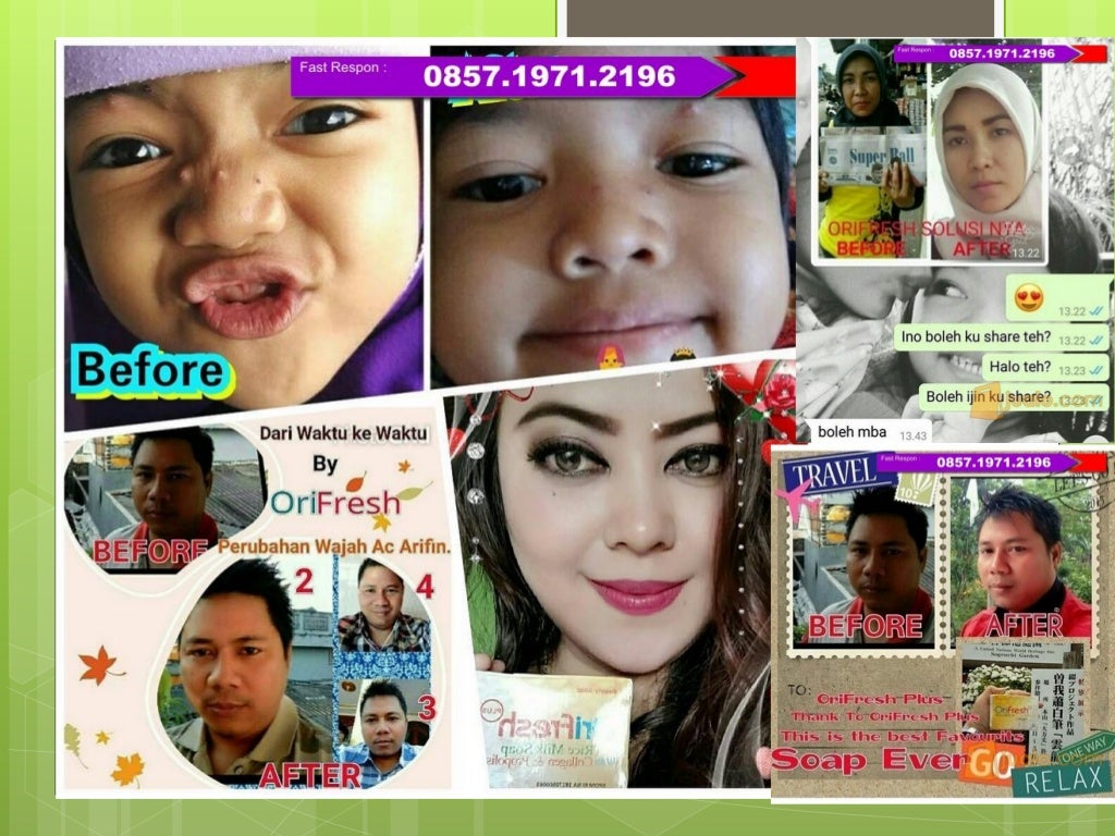 Sabun wajah menghilangkan bekas jerawat, sabun wajah wanita, sabun wa…