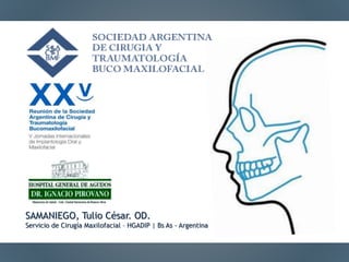 SAMANIEGO, Tulio César. DDS. Msc.
Servicio de Cirugía Maxilofacial – HGADIP | Buenos Aires - Argentina
 