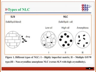 »Types of NLC
6