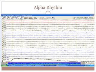 Alpha Rhythm
 