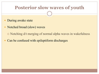 Posterior slow waves of youth
 During awake state
 Notched broad (slow) waves
 Notching d/t merging of normal alpha waves in wakefulness
 Can be confused with epileptiform discharges
 