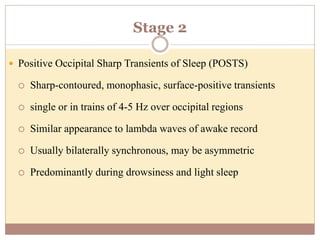 Stage 2
 Positive Occipital Sharp Transients of Sleep (POSTS)
 Sharp-contoured, monophasic, surface-positive transients
 single or in trains of 4-5 Hz over occipital regions
 Similar appearance to lambda waves of awake record
 Usually bilaterally synchronous, may be asymmetric
 Predominantly during drowsiness and light sleep
 