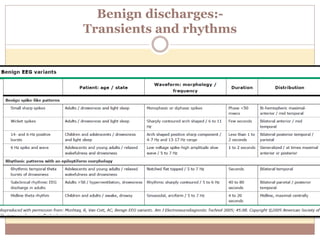 Benign discharges:-
Transients and rhythms
 