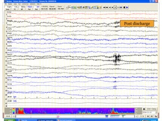 Post discharge
 