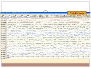 Post discharge
 